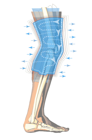 Diagram of Game Ready cold compression therapy applied to the leg
